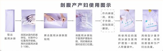 剖腹產